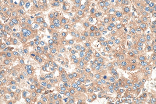 [12092-1-AP-150UL] FKBP7 Polyclonal antibody