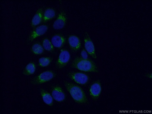 [12095-1-AP-20UL] GOSR2/Membrin Polyclonal antibody