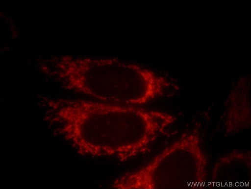 [12096-1-AP-150UL] DNAJC19 Polyclonal antibody