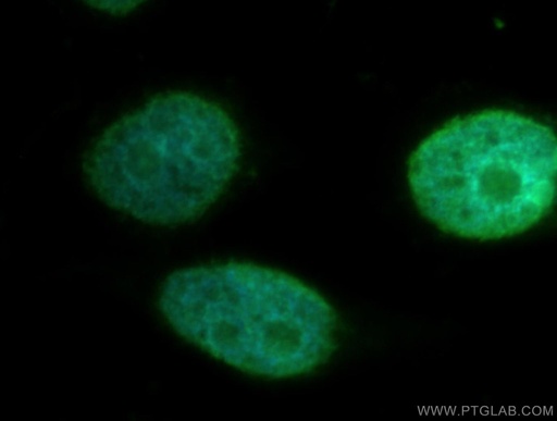 [12097-1-AP-150UL] STK3 Polyclonal antibody