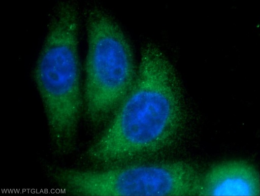 [12102-1-AP-150UL] PBXIP1 Polyclonal antibody