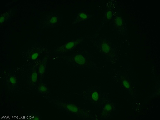 [12106-1-AP-20UL] PTMS Polyclonal antibody