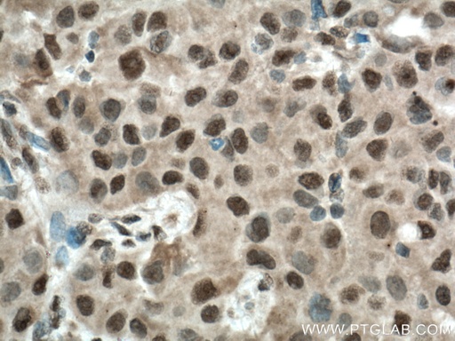 [12107-1-AP-20UL] BCOR Polyclonal antibody