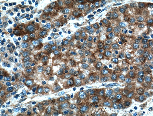 [12109-1-AP-20UL] PTPN9 Polyclonal antibody