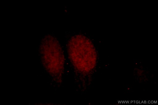 [12111-1-AP-20UL] DPF2 Polyclonal antibody