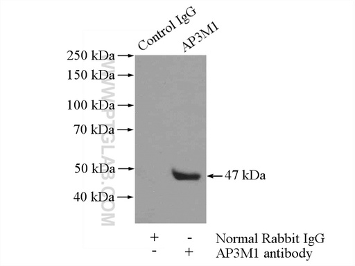 [12114-1-AP-150UL] AP3M1 Polyclonal antibody