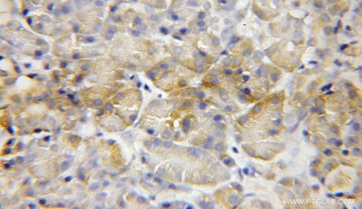 [12117-1-AP-150UL] MCCC2 Polyclonal antibody