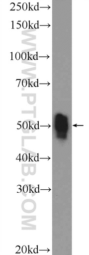 [12118-1-AP-150UL] ETS1 Polyclonal antibody