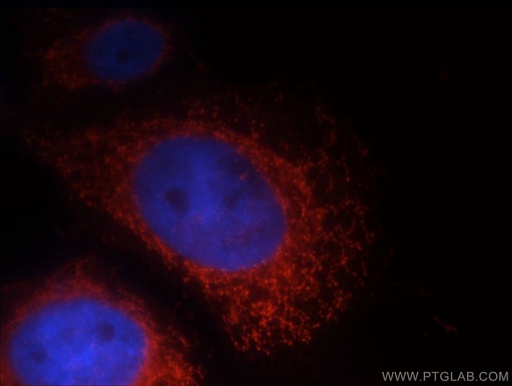 [12119-1-AP-150UL] LRDD Polyclonal antibody