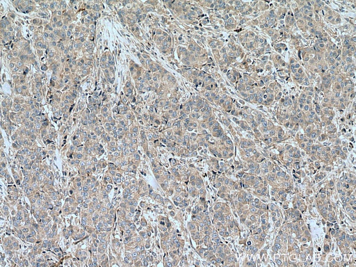 [12120-1-AP-20UL] SLC16A5 Polyclonal antibody