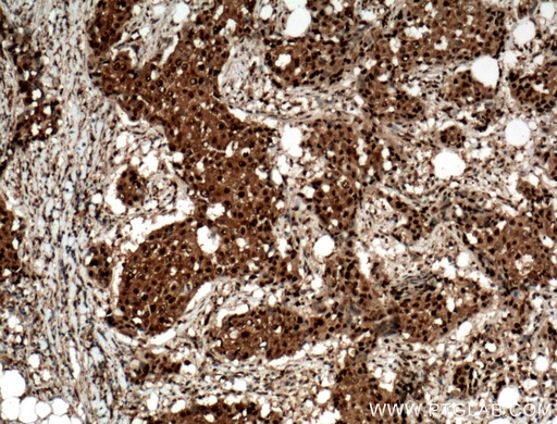 [12121-1-AP-150UL] RAD23B Polyclonal antibody