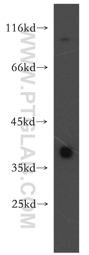 [12122-1-AP-150UL] TSPAN5 Polyclonal antibody