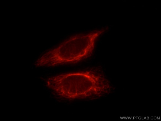 [12124-2-AP-20UL] WSB2 Polyclonal antibody