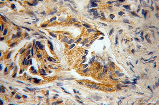 [12125-1-AP-150UL] RAB22A Polyclonal antibody