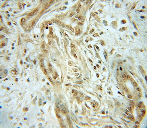 [12126-2-AP-20UL] CHRAC1 Polyclonal antibody