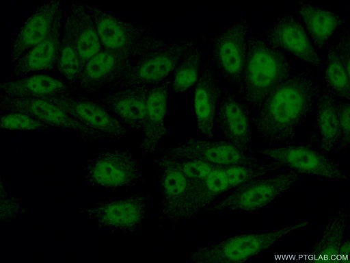 [12130-1-AP-20UL] SAP130 Polyclonal antibody