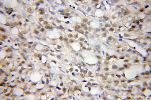 [12131-1-AP-150UL] CREM Polyclonal antibody