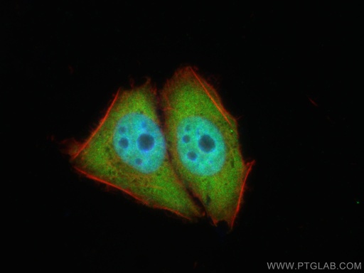 [12133-2-AP-150UL] TIA1 Polyclonal antibody