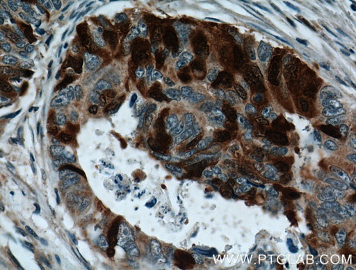 [12134-2-AP-150UL] UBE2C Polyclonal antibody