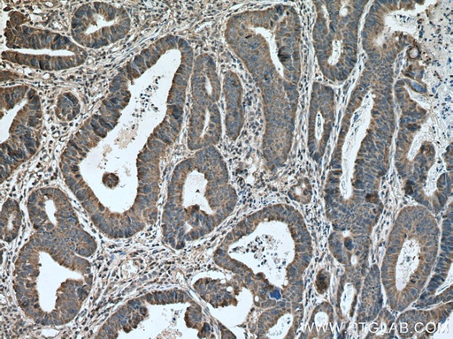 [12136-1-AP-20UL] NXT2 Polyclonal antibody