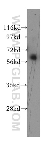 [12137-1-AP-150UL] RFX5 Polyclonal antibody