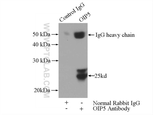 [12142-1-AP-150UL] OIP5 Polyclonal antibody