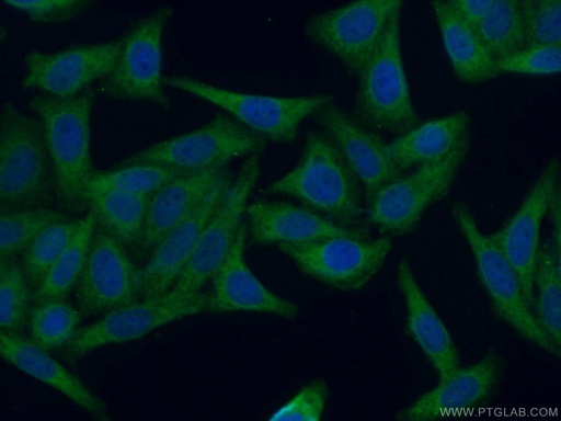 [12147-1-AP-20UL] GAK Polyclonal antibody