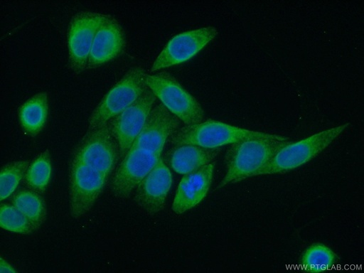 [12148-1-AP-20UL] PRKCSH Polyclonal antibody