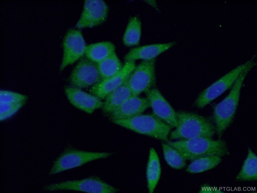 [12150-1-AP-20UL] PTS Polyclonal antibody