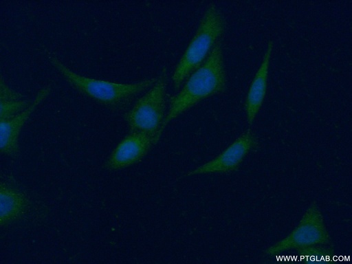 [12156-1-AP-20UL] CCBL1/KAT1 Polyclonal antibody