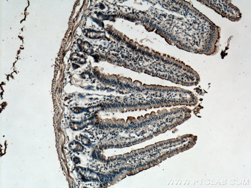 [12157-1-AP-20UL] TCN2 Polyclonal antibody