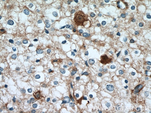 [12159-1-AP-20UL] GPRASP2 Polyclonal antibody