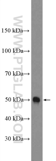 [12160-1-AP-150UL] PAR2 Polyclonal antibody