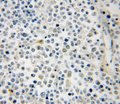 [12162-1-AP-20UL] RAB39B Polyclonal antibody
