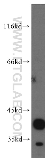 [12164-1-AP-20UL] CANT1 Polyclonal antibody