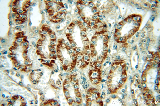 [12166-1-AP-150UL] Dysadherin Polyclonal antibody