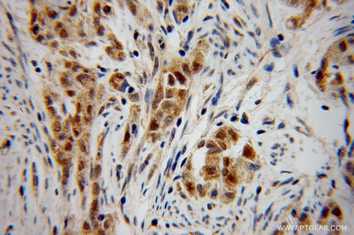[12169-1-AP-150UL] CHFR Polyclonal antibody