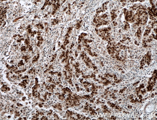 [12170-1-AP-150UL] RTF1 Polyclonal antibody