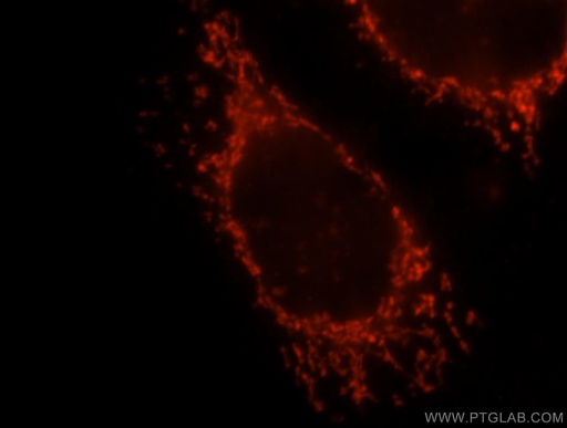 [12175-1-AP-20UL] OXCT1 Polyclonal antibody
