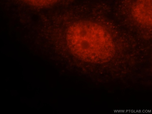 [12176-1-AP-20UL] FAM107A Polyclonal antibody