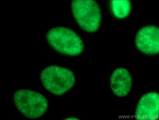 [12178-1-AP-150UL] SMNDC1 Polyclonal antibody