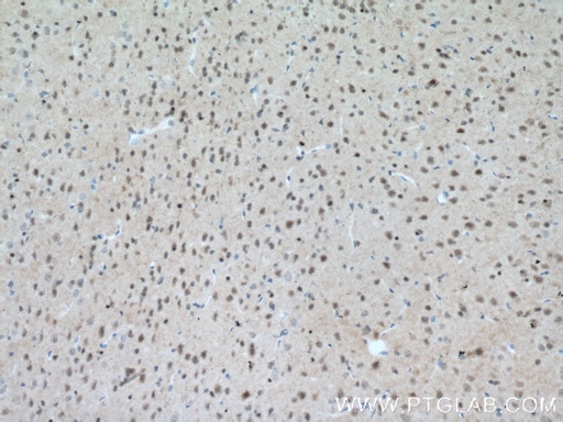 [12179-1-AP-20UL] MT3 Polyclonal antibody