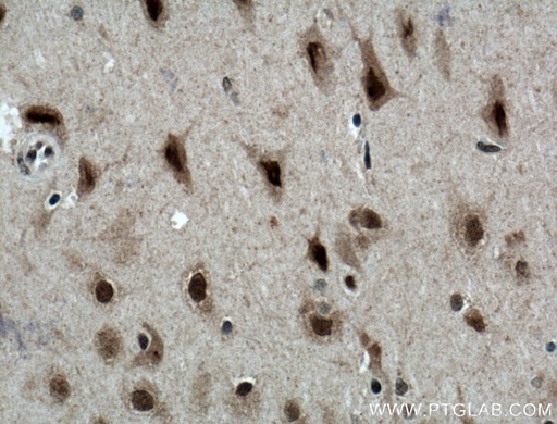 [12182-1-AP-20UL] MED8 Polyclonal antibody
