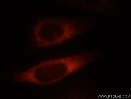 [12184-1-AP-20UL] NDRG4 Polyclonal antibody