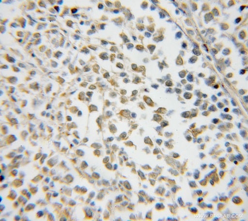 [12185-1-AP-20UL] NXF2 Polyclonal antibody