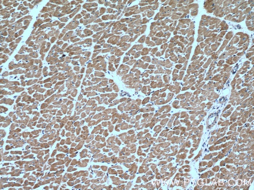 [12186-1-AP-150UL] MFN2 Polyclonal antibody