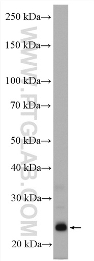 [12191-1-AP-20UL] Endothelin 1 Polyclonal antibody