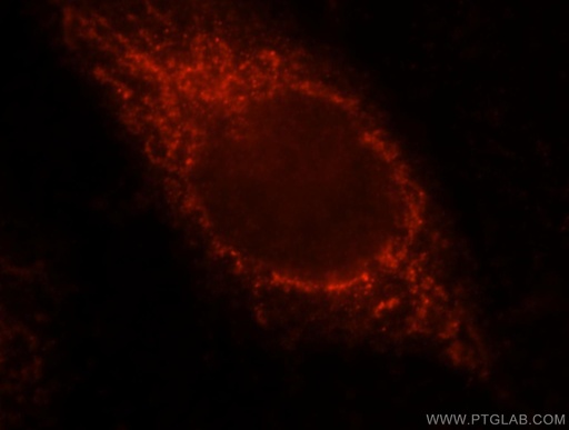 [12195-1-AP-150UL] VPS33B Polyclonal antibody