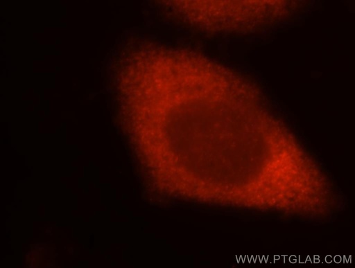 [12196-1-AP-150UL] TOMM34 Polyclonal antibody