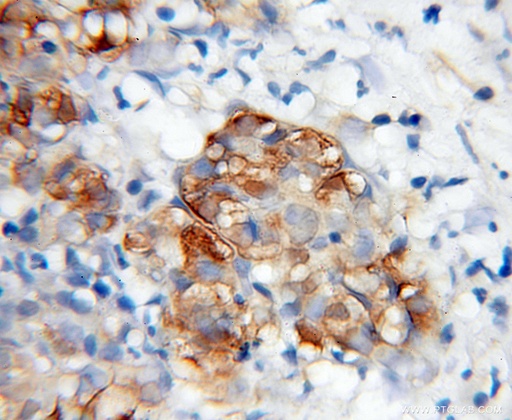 [12197-1-AP-150UL] WWP2 Polyclonal antibody